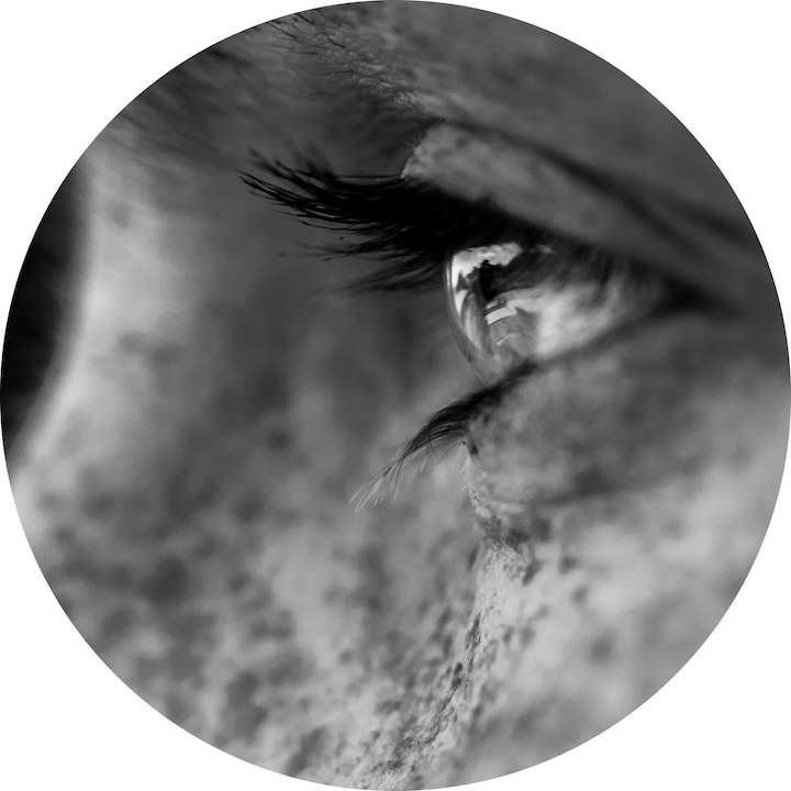 Open Eye